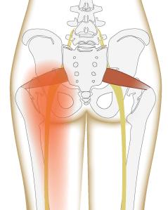 位置:疼痛通常会出现在臀部中间的位置,下背部,或任何坐骨神经通过