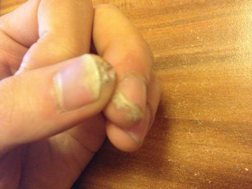 我的手指甲缝里长有又干又硬的肉.