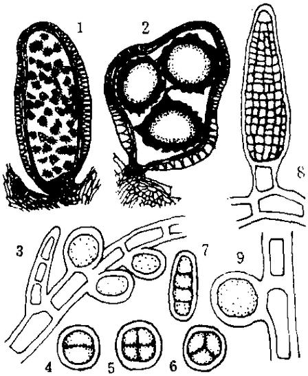 大孢子囊产生大孢子,发育成雌配子体,小孢子囊产生小孢子
