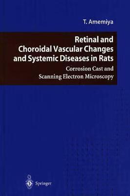 预订 retinal and choroidal vascular changes and systemic
